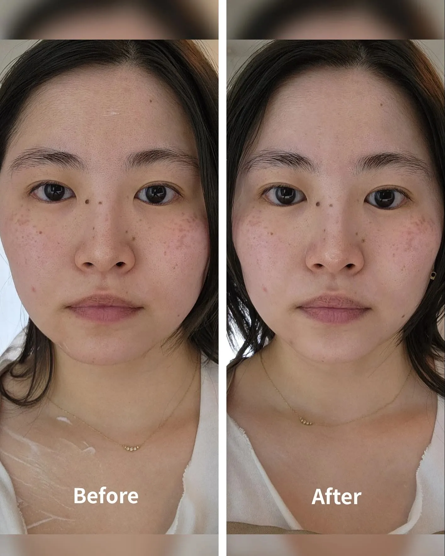 【スタッフの変化〜フェイシャルケア】